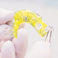 Kieferorthopädie für Kinder in München - herausnehmbare Zahnspangen